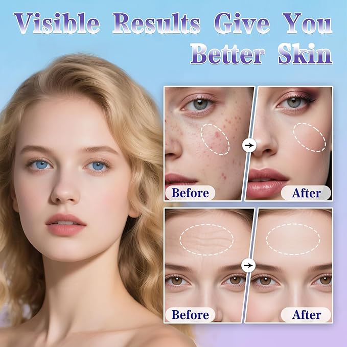 Dermodots Derma Stamp