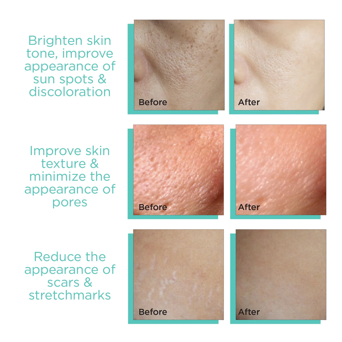 Dermodots Derma Stamp