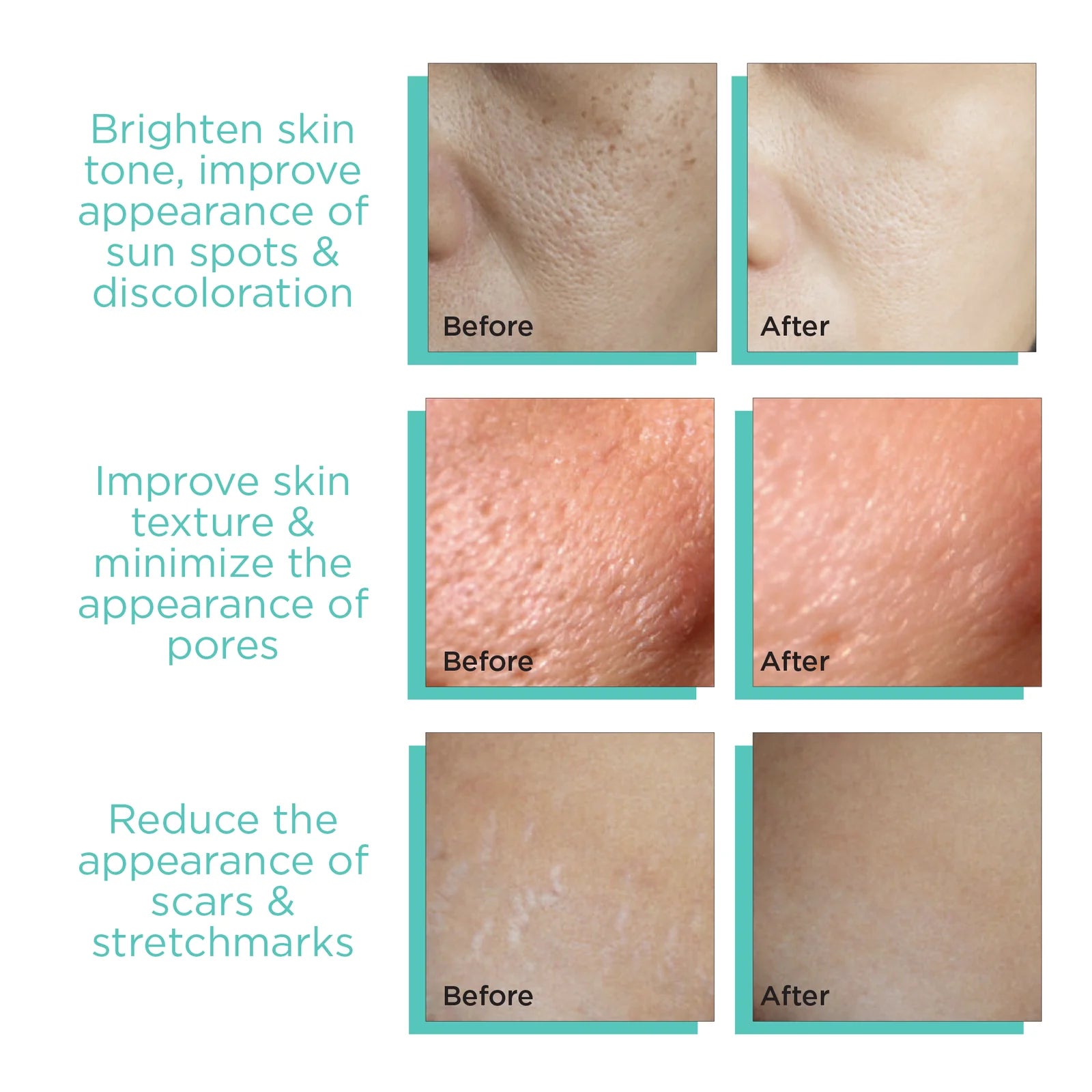 Dermodots Derma Stamp