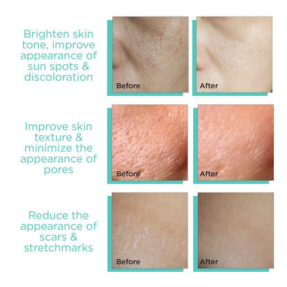 Dermodots Derma Stamp